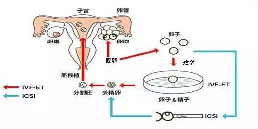 南充代怀孕捐卵有哪些